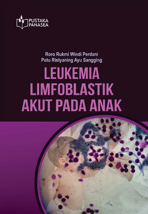 Sampul buku Leukemia Limfoblasti...